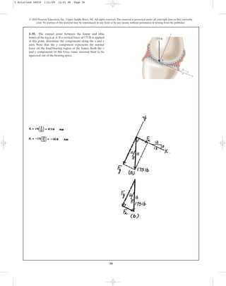 36
2–35. The contact point between the femur and tibia
bones of the leg is at A. If a vertical force of 175 lb is applied
at this point, determine the components along the x and y
axes. Note that the y component represents the normal
force on the load-bearing region of the bones. Both the x
and y components of this force cause synovial fluid to be
squeezed out of the bearing space.
© 2010 Pearson Education, Inc., Upper Saddle River, NJ. All rights reserved.This material is protected under all copyright laws as they currently
exist. No portion of this material may be reproduced, in any form or by any means, without permission in writing from the publisher.
x
A
175 lb
12
5
13
y
2 Solutions 44918 1/21/09 12:01 PM Page 36
 