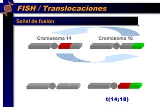 FISH / Translocaciones
Cromosoma 14 Cromosoma 18
t(14;18)
Señal de fusión
 