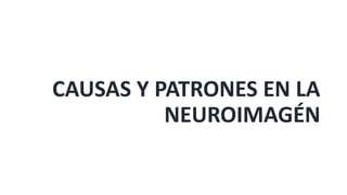 CAUSAS Y PATRONES EN LA
NEUROIMAGÉN
 
