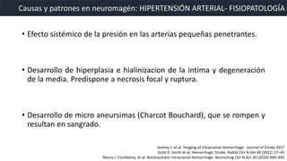 • Efecto sistémico de la presión en las arterias pequeñas penetrantes.
• Desarrollo de hiperplasia e hialinizacion de la intima y degeneración
de la media. Predispone a necrosis focal y ruptura.
• Desarrollo de micro aneursimas (Charcot Bouchard), que se rompen y
resultan en sangrado.
Causas y patrones en neuromagén: HIPERTENSIÓN ARTERIAL- FISIOPATOLOGÍA
Jeremy J. et al. Imaging of Intracranial Hemorrhage. Journal of Stroke 2017
Scott D. Smith et al, Hemorrhagic Stroke. Radiol Clin N Am 49 (2011) 27–45
Nancy J. Fischbeina, et al. Nontraumatic Intracranial Hemorrhage. Neuroimag Clin N Am 20 (2010) 469–492
 