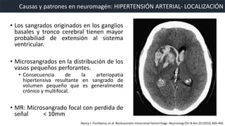 • Los sangrados originados en los ganglios
basales y tronco cerebral tienen mayor
probabiliad de extensión al sistema
ventricular.
• Microsangrados en la distribución de los
vasos pequeños perforantes.
• Consecuencia de la arteriopatia
hipertensiva resultante en sangrado de
volumen pequeño que es generalmente
crónico y multifocal.
• MR: Microsangrado focal con perdida de
señal < 10mm
Causas y patrones en neuromagén: HIPERTENSIÓN ARTERIAL- LOCALIZACIÓN
Nancy J. Fischbeina, et al. Nontraumatic Intracranial Hemorrhage. Neuroimag Clin N Am 20 (2010) 469–492
 
