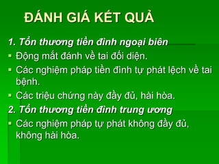 ĐÁNH GIÁ KẾT QUẢ
1. Tổn thương tiền đình ngoại biên
 Động mắt đánh về tai đối diện.
 Các nghiệm pháp tiền đình tự phát lệch về tai
bệnh.
 Các triệu chứng này đầy đủ, hài hòa.
2. Tổn thương tiền đình trung ương
 Các nghiệm pháp tự phát không đầy đủ,
không hài hòa.
 