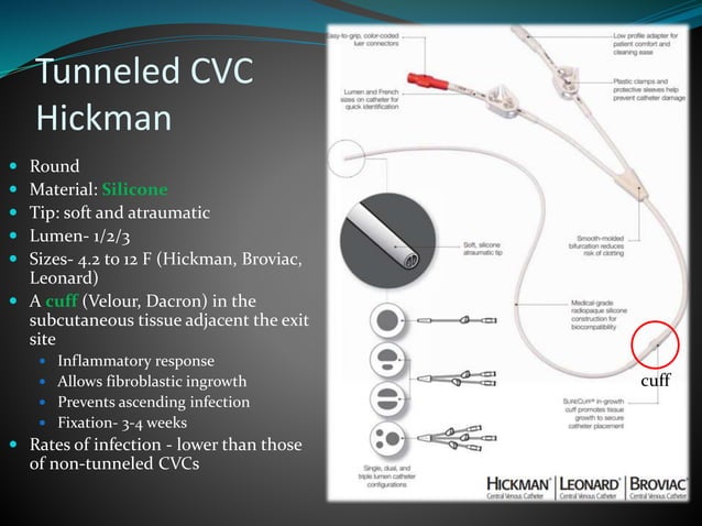 Hickman Catheter An Overview Details About Hickman Insertion Care Hickman Catheter An Overview Details About Hickman Insertion Care