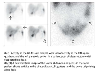 HIDA Scan | PPTX