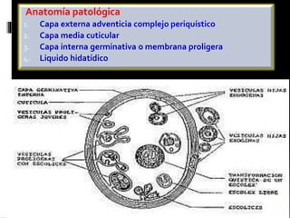 Anatomía patológica 
1. Capa externa adventicia complejo periquístico 
2. Capa media cuticular 
3. Capa interna germinativ...