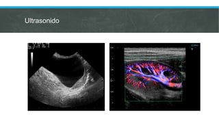 Ultrasonido
 