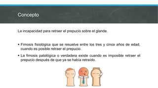 Concepto
La incapacidad para retraer el prepucio sobre el glande.
 Fimosis fisiológica que se resuelve entre los tres y cinco años de edad,
cuando es posible retraer el prepucio.
 La fimosis patológica o verdadera existe cuando es imposible retraer el
prepucio después de que ya se había retraído.
 