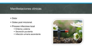Manifestaciones clínicas
 Dolor
 Goteo post miccional.
 Proceso infeccioso local
 Eritema y edema
 Secreción purulenta
 Infección urinaria ascendente
 