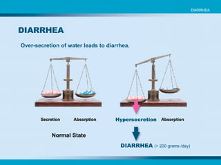 Over-secretion of water leads to diarrhea. Hypersecretion DIARRHEA   (> 200 grams /day) Secretion Absorption Absorption Normal State DIARRHEA DIARRHEA 