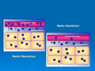 Medio Hipertónico Medio Hipotónico 