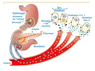 Estómago Insulina Glucosa Alimento se “rompe” Páncreas Arteria Diabetes tipo 1  Sin diabetes Diabetes tipo 2  Receptor de insulina Duodeno 