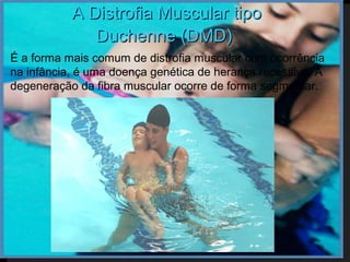 A Distrofia Muscular tipo
              Duchenne (DMD)
É a forma mais comum de distrofia muscular com ocorrência
na infância, é uma doença genética de herança recessiva. A
degeneração da fibra muscular ocorre de forma segmentar.
 