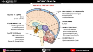 @ rcarrillo.medicina RCarrillo - Medicina
HIDROCEFALEA
CAUSAS DE OBSTRUCCIONES
Estenosis acueductal
Bifurcación acueductal
Gliosis subependimaria
Gliomas periacueductales
ACUEDUCTO DE SILVIO
REGIÓN PINEAL
OBSTRUCCIÓN EN LA ABSORCIÓN
AGUJERO DE MONRO
TERCER VENTRICULO
CUARTO VENTRICULO
Gliosis
Quistes coloides
Gliomas quiasmales
Craneofaringiomas
Quistes aracnoideos
Meduloblastomas
Ependimomas
Astrocitomas
Quistes de Dandy-Walker
Aracnoiditis (poshemorrágica)
Posmeningítico
Trombosis venosa
Malformaciones de Chiari
BULBO RAQUIDEO
 