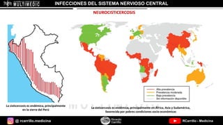 @ rcarrillo.medicina RCarrillo - Medicina
INFECCIONES DEL SISTEMA NERVIOSO CENTRAL
NEUROCISTICERCOSIS
La cisticercosis es endémica, principalmente en África, Asia y Sudamérica,
favorecida por pobres condiciones socio-económicas
La cisticercosis es endémica, principalmente
en la sierra del Perú
 