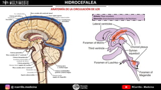 @ rcarrillo.medicina RCarrillo - Medicina
HIDROCEFALEA
ANATOMÍA DE LA CIRCULACIÓN DE LCR
Síntesis: Plexo coroideos.
Absorción: Granulaciones aracnoides o de Pacchioni.
 