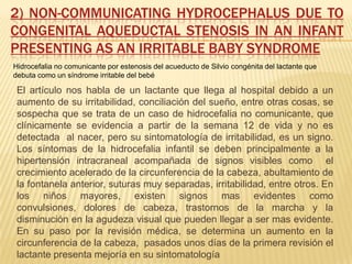 Hidrocefalia Slide 13