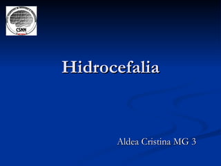 Hidrocefalia


      Aldea Cristina MG 3
 