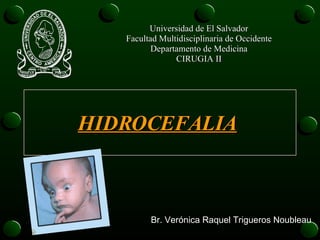 Universidad de El Salvador Facultad Multidisciplinaria de Occidente Departamento de Medicina CIRUGIA II HIDROCEFALIA Br. Verónica Raquel Trigueros Noubleau 