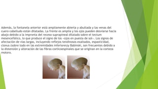 Además, la fontanela anterior está ampliamente abierta y abultada y las venas del
cuero cabelludo están dilatadas. La frente es amplia y los ojos pueden desviarse hacia
abajo debido a la impronta del receso suprapineal dilatado sobre el tectum
mesencefálico, lo que produce el signo de los «ojos en puesta de sol». Los signos de
afectación de vías largas, incluyendo reflejos tendinosos exaltados, espasticidad,
clonus (sobre todo en las extremidades inferiores)y Babinski, son frecuentes debido a
la distensión y alteración de las fibras corticoespinales que se originan en la corteza
motora.
 