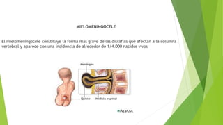 MIELOMENINGOCELE
El mielomeningocele constituye la forma más grave de las disrafias que afectan a la columna
vertebral y aparece con una incidencia de alrededor de 1/4.000 nacidos vivos
 