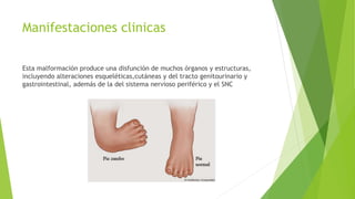 Manifestaciones clinicas
Esta malformación produce una disfunción de muchos órganos y estructuras,
incluyendo alteraciones esqueléticas,cutáneas y del tracto genitourinario y
gastrointestinal, además de la del sistema nervioso periférico y el SNC
 