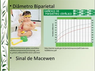 • Diâmetro Biparietal 
http://revistacrescer.globo.com/Editor 
aGlobo/componentes/article/edg_artic 
le_print/1,3916,433750-2213-1,00.html 
• Sinal de Macewen 
http://portal.saude.gov.br/portal/arquivos/pdf/Caderneta 
%20Menino.pdf 
 