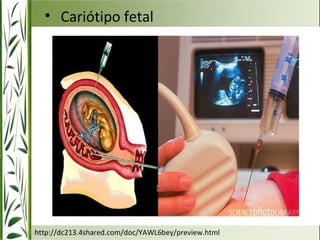 • Cariótipo fetal 
http://dc213.4shared.com/doc/YAWL6bey/preview.html 
 