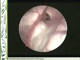 Fonte:http://www.youtube.com/watch?v=ZlXGtLu8Cjw 
 