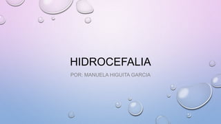 HIDROCEFALIA
POR: MANUELA HIGUITA GARCIA
 