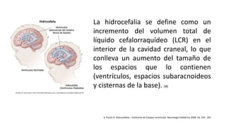 La hidrocefalia se define como un
incremento del volumen total de
líquido cefalorraquídeo (LCR) en el
interior de la cavidad craneal, lo que
conlleva un aumento del tamaño de
los espacios que lo contienen
(ventrículos, espacios subaracnoideos
y cisternas de la base). (4)
4. Puche A. Hidrocefalias – Síndrome de Colapso ventricular. Neurología Pediátrica 2008: 26; 194 - 201
Tomado de: http://aemc-chiari.com/index.php?option=com_content&view=article&id=61&Itemid=93
 