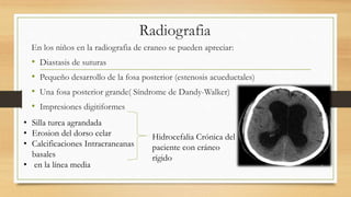 Radiografia
En los niños en la radiografia de craneo se pueden apreciar:
• Diastasis de suturas
• Pequeño desarrollo de la fosa posterior (estenosis acueductales)
• Una fosa posterior grande( Síndrome de Dandy-Walker)
• Impresiones digitiformes
• Silla turca agrandada
• Erosion del dorso celar
• Calcificaciones Intracraneanas
basales
• en la línea media
Hidrocefalia Crónica del
paciente con cráneo
rígido
 