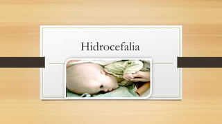Hidrocefalia
 