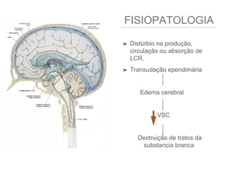 Hidrocefalia | PPTX