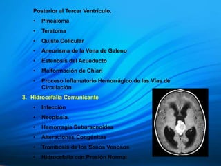 Posterior al Tercer Ventrículo.
• Pinealoma
• Teratoma
• Quiste Colicular
• Aneurisma de la Vena de Galeno
• Estenosis del Acueducto
• Malformación de Chiari
• Proceso Inflamatorio Hemorrágico de las Vías de
Circulación
3. Hidrocefalia Comunicante
• Infección
• Neoplasia.
• Hemorragia Subaracnoidea
• Alteraciones Congénitas
• Trombosis de los Senos Venosos
• Hidrocefalia con Presión Normal
 