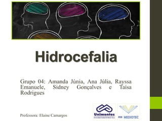 Hidrocefalia
Grupo 04: Amanda Júnia, Ana Júlia, Rayssa
Emanuele, Sidney Gonçalves e Taísa
Rodrigues
Professora: Elaine Camargos
 