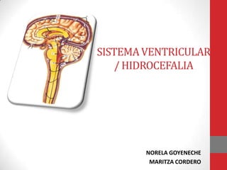 SISTEMA VENTRICULAR
/ HIDROCEFALIA
NORELA GOYENECHE
MARITZA CORDERO
 