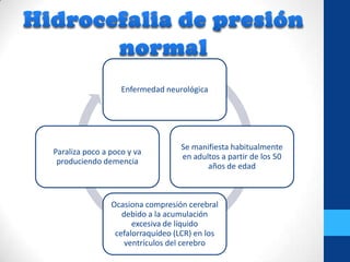 Hidrocefalia final (2)