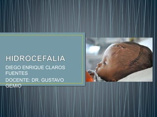 DIEGO ENRIQUE CLAROS
FUENTES
DOCENTE: DR. GUSTAVO
GEMIO
 