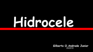 05/2016
Hidrocele
Gilberto O.Andrade Junior
 