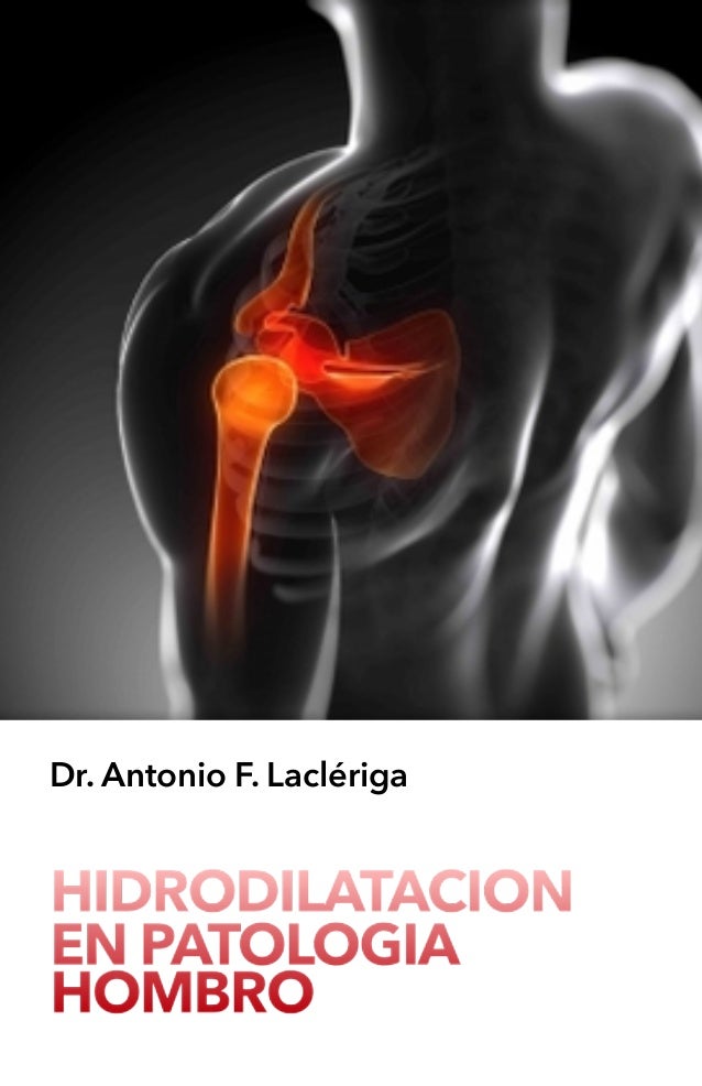HIDRODILATACION
EN PATOLOGIA
HOMBRO
Dr. Antonio F. Laclériga
 