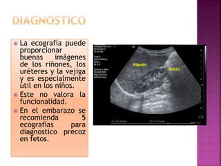  La ecografía puede
proporcionar
buenas imágenes
de los riñones, los
uréteres y la vejiga
y es especialmente
útil en los niños.
 Este no valora la
funcionalidad.
 En el embarazo se
recomienda 5
ecografías para
diagnostico precoz
en fetos.
 