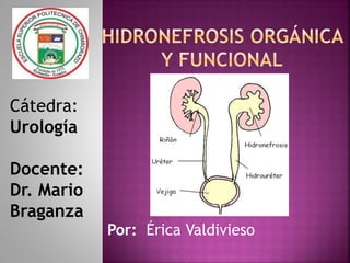 Por: Érica Valdivieso
Cátedra:
Urología
Docente:
Dr. Mario
Braganza
 