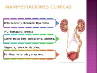 Dolor lumbar y abdominal tipo cólico
IVU, hematuria, uremia
A nivel tracto bajo: polaquiuria, tenesmo,
Urgencia, retención...