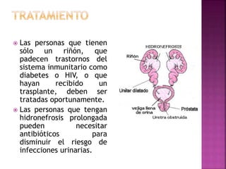  Las personas que tienen
sólo un riñón, que
padecen trastornos del
sistema inmunitario como
diabetes o HIV, o que
hayan recibido un
trasplante, deben ser
tratadas oportunamente.
 Las personas que tengan
hidronefrosis prolongada
pueden necesitar
antibióticos para
disminuir el riesgo de
infecciones urinarias.
 