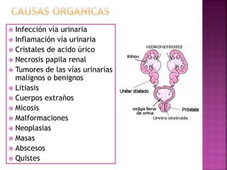  Infección vía urinaria
 Inflamación vía urinaria
 Cristales de acido úrico
 Necrosis papila renal
 Tumores de las ví...