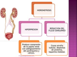 HIDRONEFROSIS
HIPERPRESION
Produce compresión
de la papila renal
con adelgazamiento
del parénquima y
cálices.
REDUCCION DE...