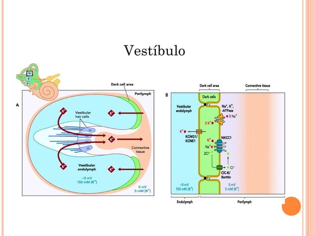 Hidropesía Endolinfática