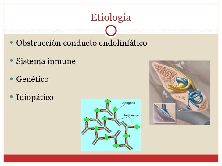 Hidrops endolinfático