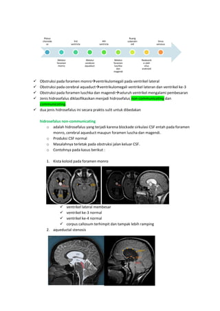  Obstruksi pada foramen monroventrikulomegali pada ventrikel lateral
 Obstruksi pada cerebral aquaductventrikulomegali ventrikel lateran dan ventrikel ke-3
 Obstruksi pada foramen luschka dan magendiseluruh ventrikel mengalami pembesaran
 Jenis hidrosefalus diklasifikasikan menjadi hidrosefalus non-communicating dan
communicating.
 dua jenis hidrosefalus ini secara praktis sulit untuk dibedakan
hidrosefalus non-communicating
o adalah hidrosefalus yang terjadi karena blockade sirkulasi CSF entah pada foramen
monro, cerebral aqueduct maupun foramen luscha dan magendi.
o Produksi CSF normal
o Masalahnya terletak pada obstruksi jalan keluar CSF.
o Contohnya pada kasus berikut :
1. Kista koloid pada foramen monro
 ventrikel lateral membesar
 ventrikel ke-3 normal
 ventrikel ke-4 normal
 corpus callosum terhimpit dan tampak lebih ramping
2. aqueductal stenosis
Plexus
choroide
us
Melalui
foramen
monro
3rd
ventricle
Melalui
cerebran
aquaduct
4th
ventricle
Melalui
foramen
luschka
dan
magendi
Ruang
subarakn
oid
Reabsorb
si oleh
vilus
araknoid
Sinus
venosus
 