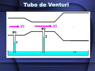Tubo de Venturi
 